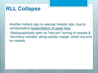 RLL Collapse 
 Another indirect sign is vascular nodular sign, due to 
compensatory hyperinflation of upper lobe. 
 Radiographically seen as "hair-pin" turning of vessels & 
"too-many nodules" along cardiac margin, which are end-on 
vessels. 
 
