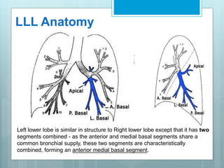 LLL Anatomy 
Left lower lobe is similar in structure to Right lower lobe except that it has two 
segments combined - as the anterior and medial basal segments share a 
common bronchial supply, these two segments are characteristically 
combined, forming an anterior medial basal segment. 
 