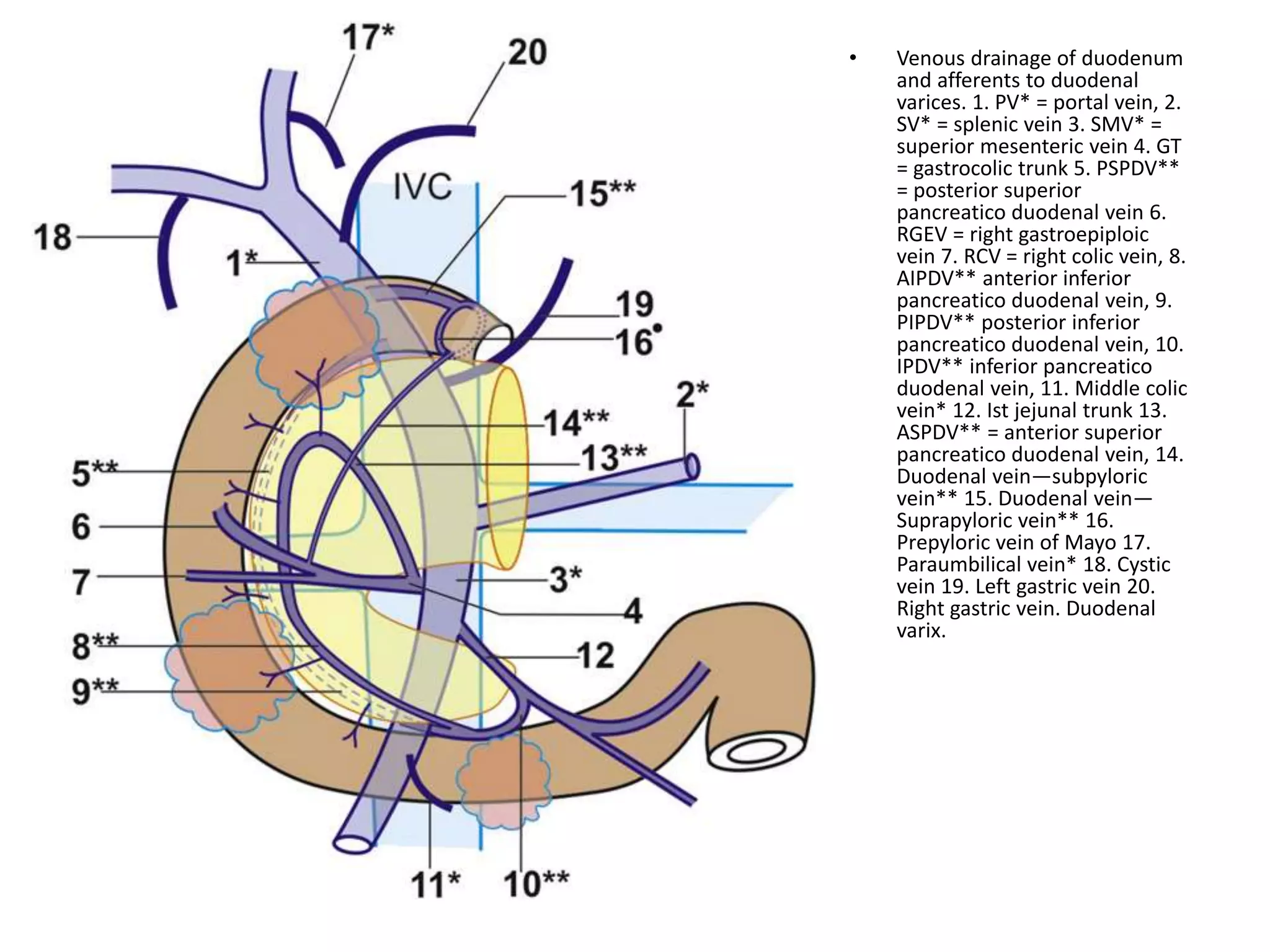 • Venous drainage of duodenum
and afferents to duodenal
varices. 1. PV* = portal vein, 2.
SV* = splenic vein 3. SMV* =
superior mesenteric vein 4. GT
= gastrocolic trunk 5. PSPDV**
= posterior superior
pancreatico duodenal vein 6.
RGEV = right gastroepiploic
vein 7. RCV = right colic vein, 8.
AIPDV** anterior inferior
pancreatico duodenal vein, 9.
PIPDV** posterior inferior
pancreatico duodenal vein, 10.
IPDV** inferior pancreatico
duodenal vein, 11. Middle colic
vein* 12. Ist jejunal trunk 13.
ASPDV** = anterior superior
pancreatico duodenal vein, 14.
Duodenal vein—subpyloric
vein** 15. Duodenal vein—
Suprapyloric vein** 16.
Prepyloric vein of Mayo 17.
Paraumbilical vein* 18. Cystic
vein 19. Left gastric vein 20.
Right gastric vein. Duodenal
varix.
 