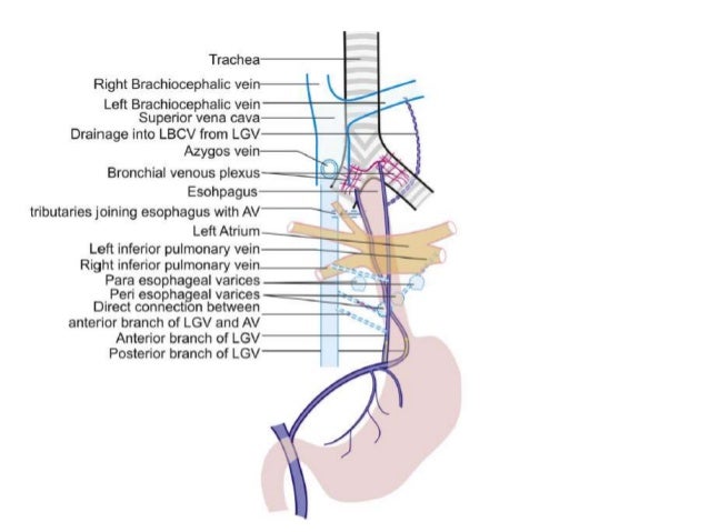 Collateral pathways in portal hypertension