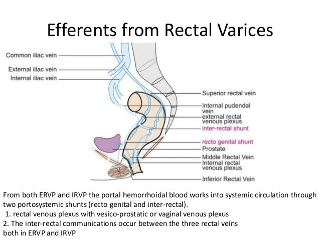 Collateral pathways in portal hypertension
