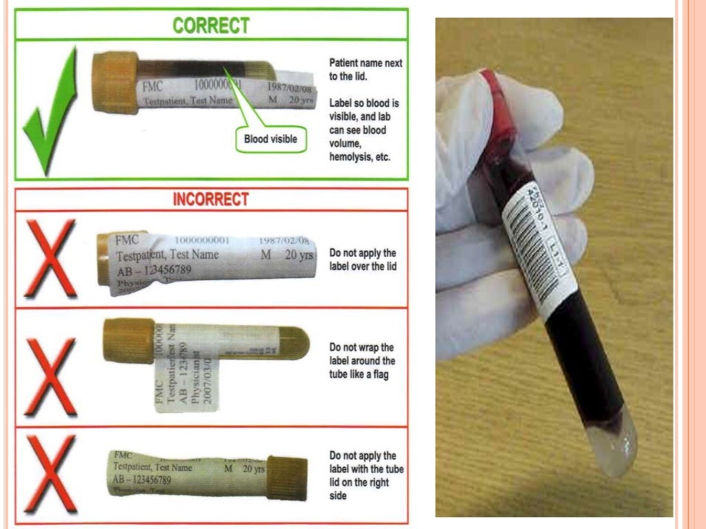 Collection and handling of blood