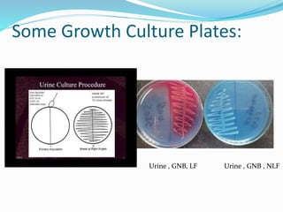 Some Growth Culture Plates:
Urine , GNB, LF Urine , GNB , NLF
 