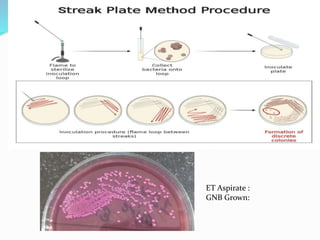 ET Aspirate :
GNB Grown:
 