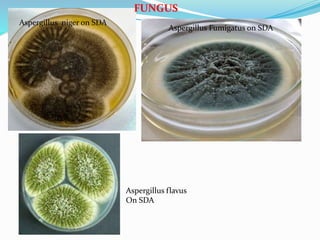 FUNGUS
Aspergillus niger on SDA
Aspergillus Fumigatus on SDA
Aspergillus flavus
On SDA
 