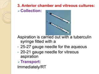 3. Anterior chamber and vitreous cultures:
 Collection:




Aspiration is carried out with a tuberculin
  syringe fitted with a
• 25-27 gauge needle for the aqueous
• 20-21 gauge needle for vitreous
  aspiration
 Transport:
Immediately/RT
 