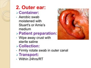 2. Outer ear:
 Container:
•   Aerobic swab
    moistened with
    Stuart's or Amie’s
    medium
 Patient    preparation:
•   Wipe away crust with
    sterile saline
 Collection:
•   Firmly rotate swab in outer canal
 Transport:
•   Within 24hrs/RT
 