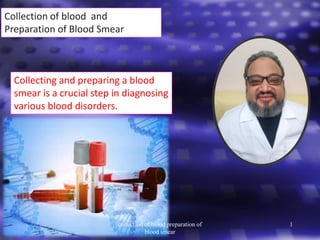 Collection of blood and
Preparation of Blood Smear
Collecting and preparing a blood
smear is a crucial step in diagnosing
various blood disorders.
collection of blood preparation of
blood smear
1
 