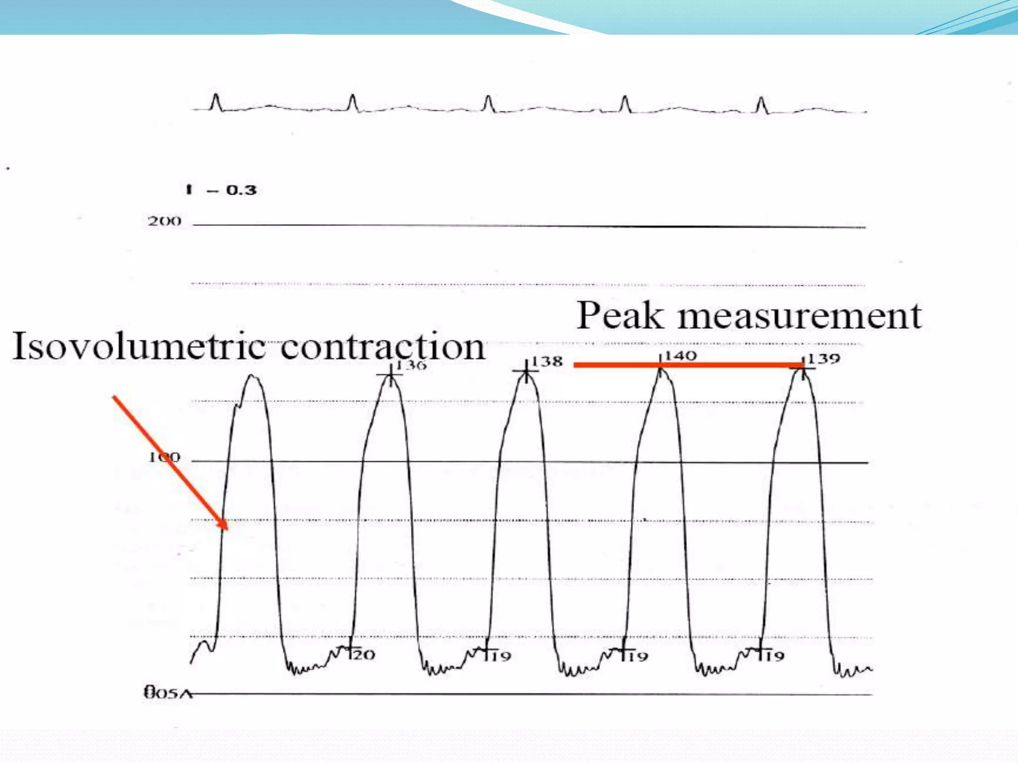 Peak systolic LV pressure
 