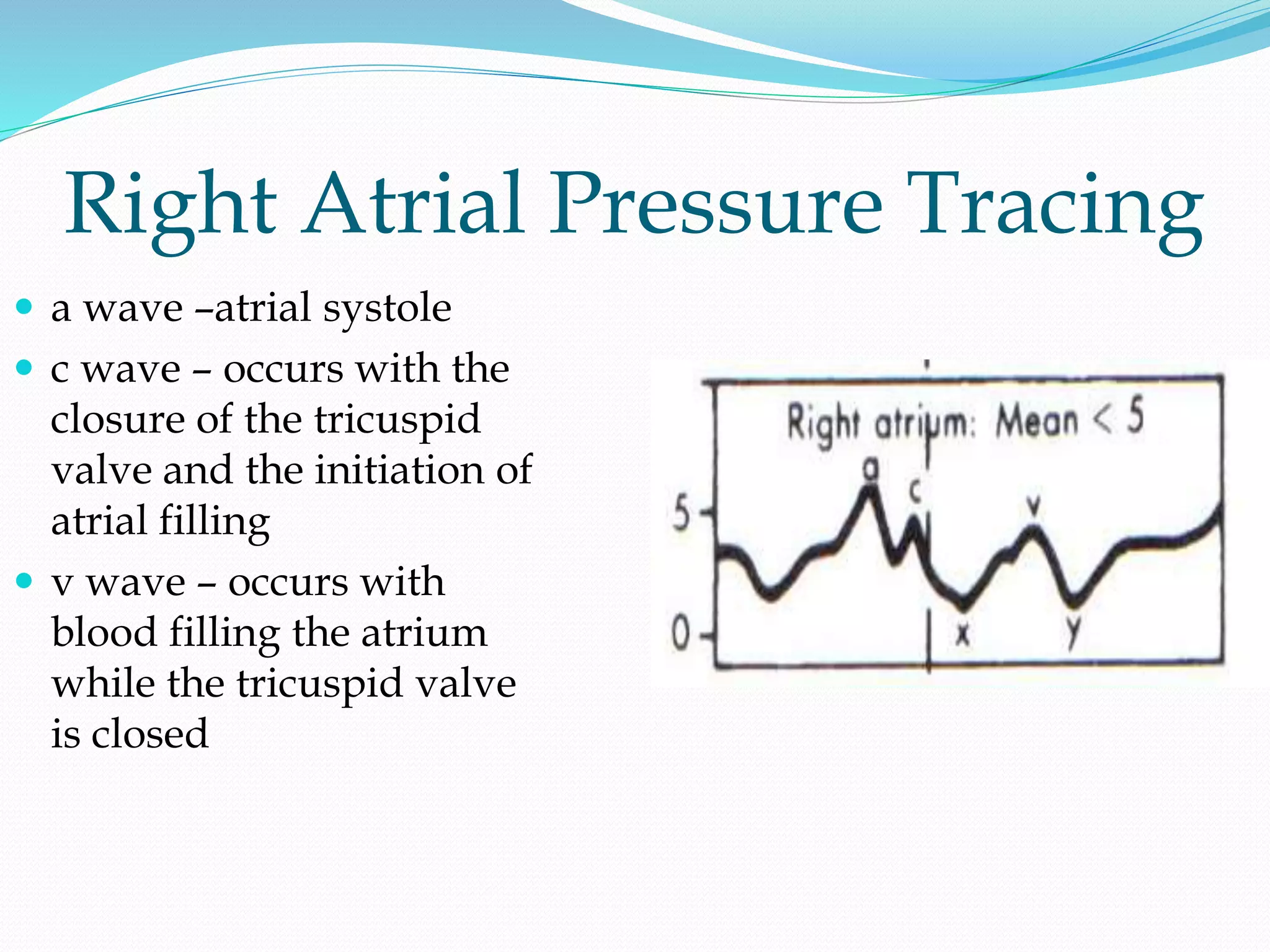 Right Atrial Pressure Tracing
 a wave –atrial systole
 c wave – occurs with the
closure of the tricuspid
valve and the initiation of
atrial filling
 v wave – occurs with
blood filling the atrium
while the tricuspid valve
is closed
 