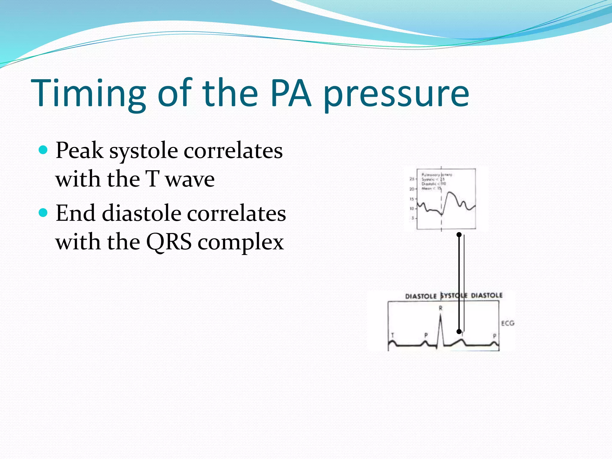 Timing of the PA pressure
 Peak systole correlates
with the T wave
 End diastole correlates
with the QRS complex
 