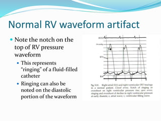 Collection of cathtracings,Dr Virbhan | PPTX