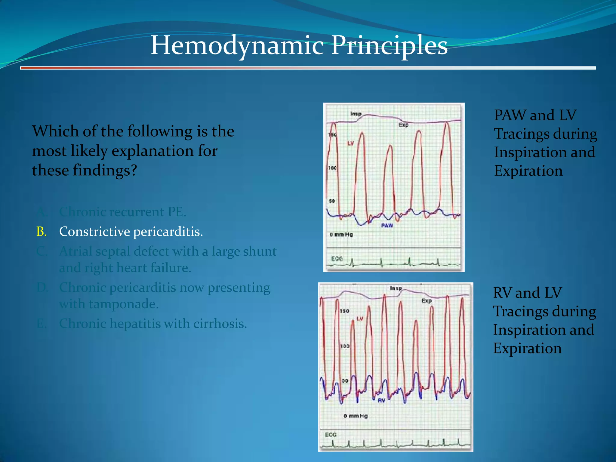 Hemodynamic Principles
Which of the following is the
most likely explanation for
these findings?
A. Chronic recurrent PE.
B. Constrictive pericarditis.
C. Atrial septal defect with a large shunt
and right heart failure.
D. Chronic pericarditis now presenting
with tamponade.
E. Chronic hepatitis with cirrhosis.

PAW and LV
Tracings during
Inspiration and
Expiration

RV and LV
Tracings during
Inspiration and
Expiration

 
