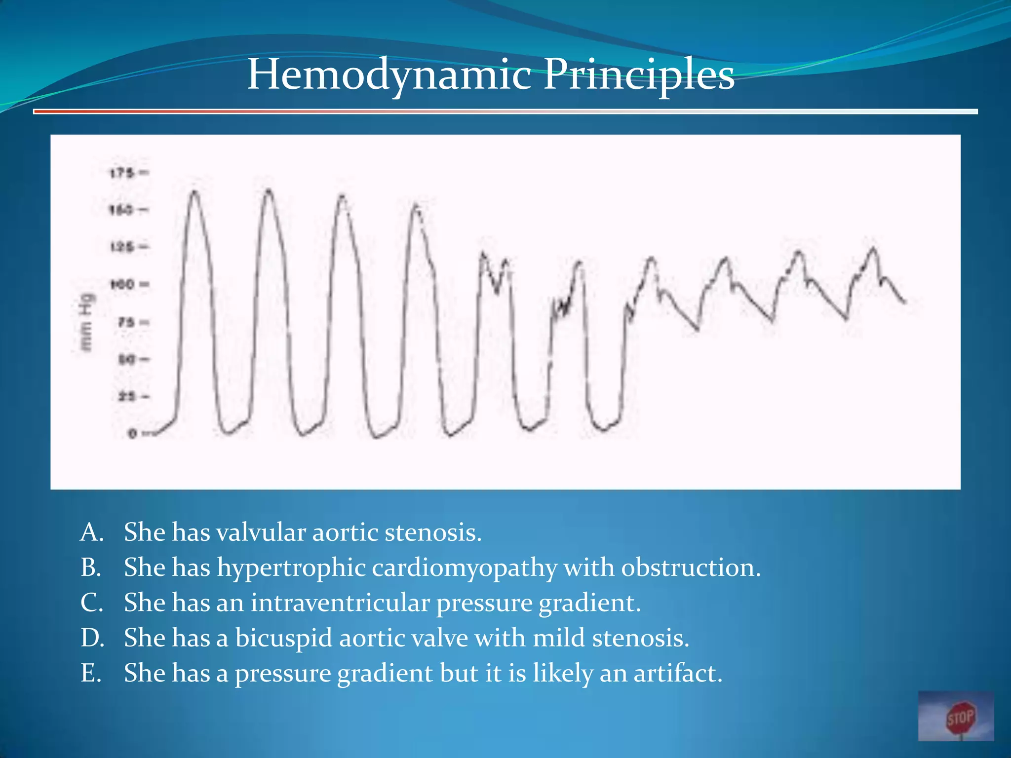 Hemodynamic Principles

A.
B.
C.
D.
E.

She has valvular aortic stenosis.
She has hypertrophic cardiomyopathy with obstruction.
She has an intraventricular pressure gradient.
She has a bicuspid aortic valve with mild stenosis.
She has a pressure gradient but it is likely an artifact.

 