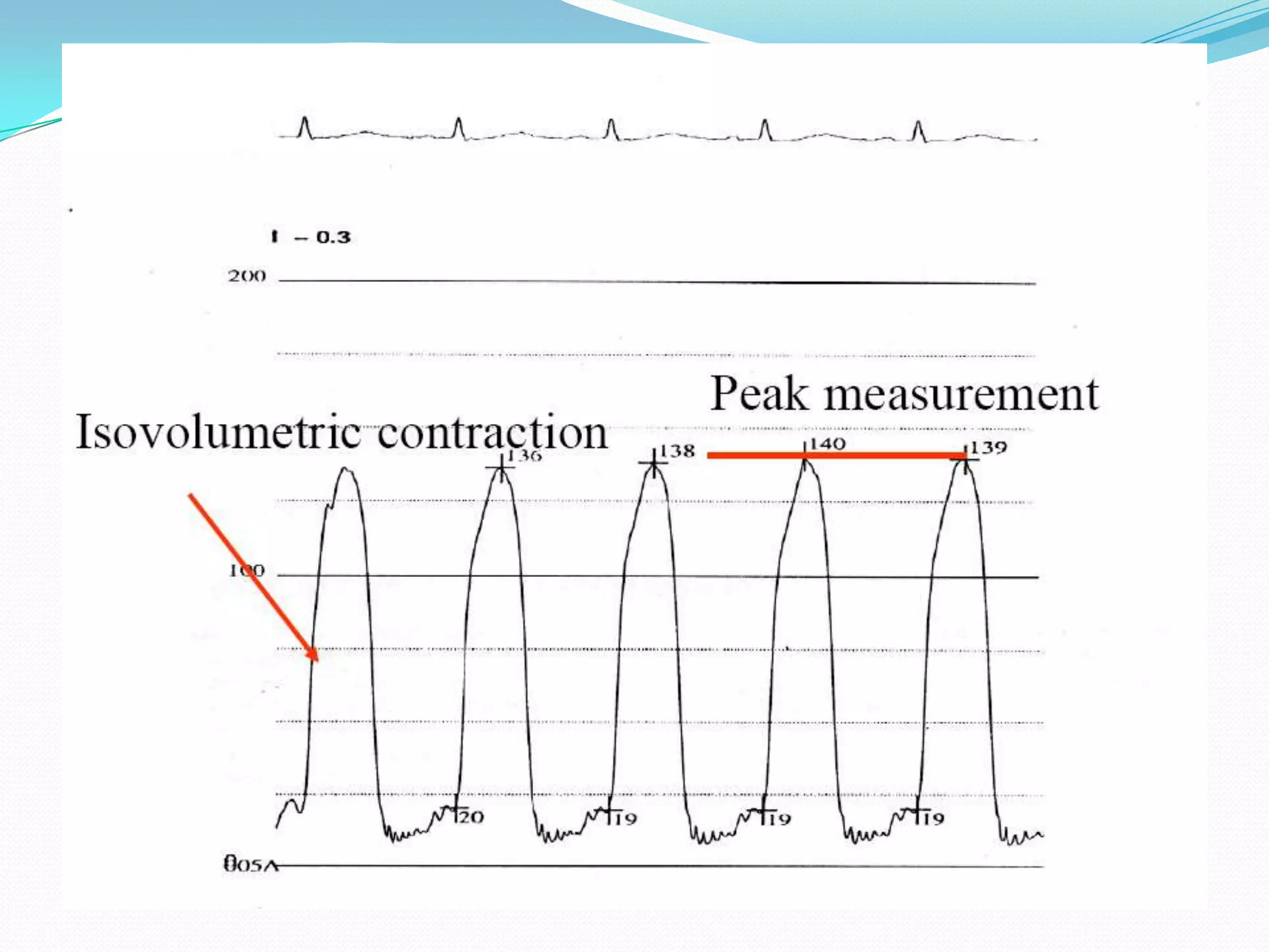 Peak systolic LV pressure

 