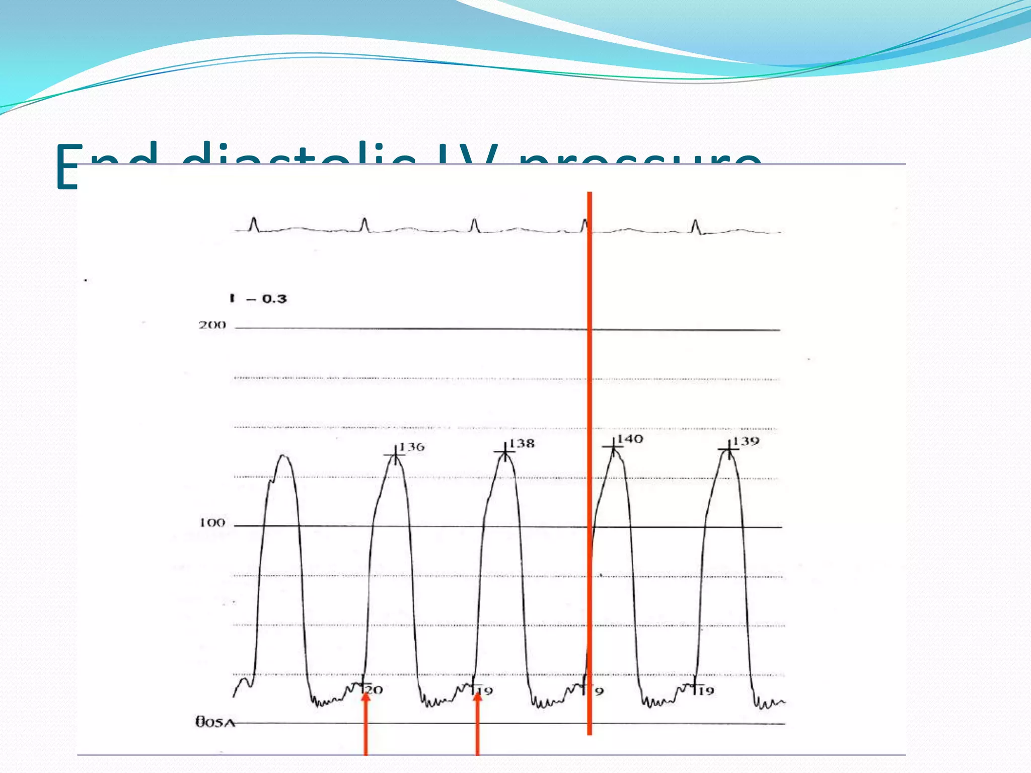 End diastolic LV pressure

 