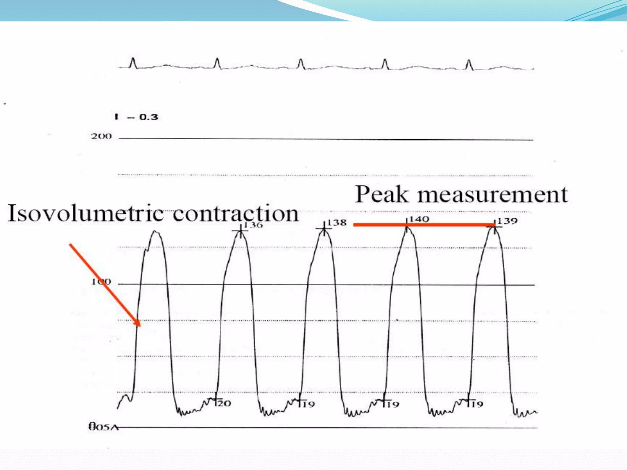 Peak systolic LV pressure

 