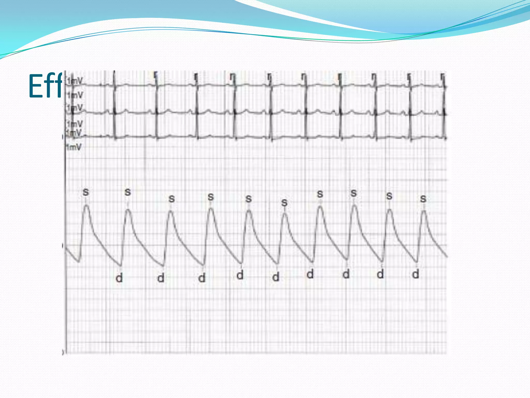 Effects of respiration

 