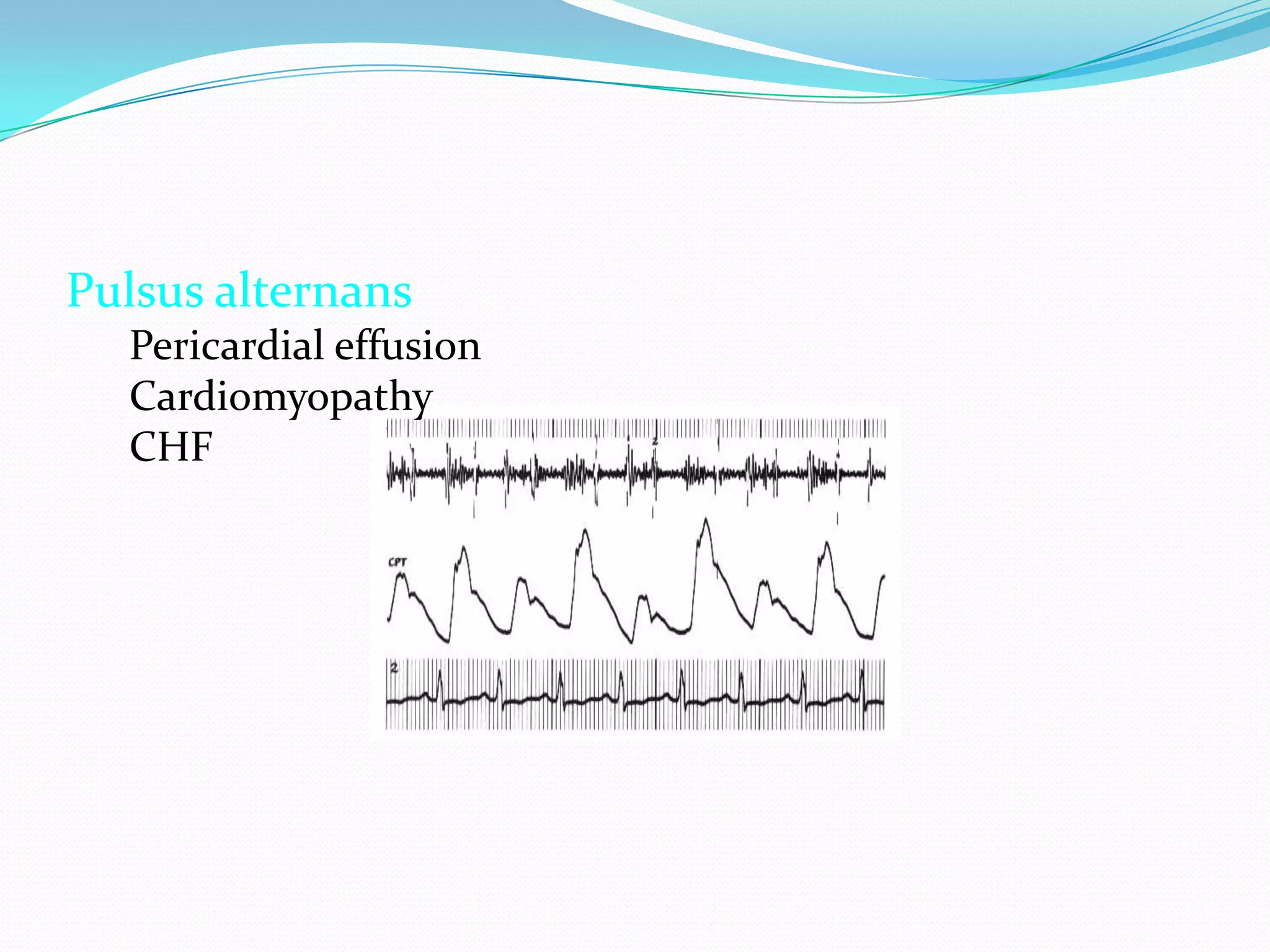 Pulsus alternans
Pericardial effusion
Cardiomyopathy
CHF

 