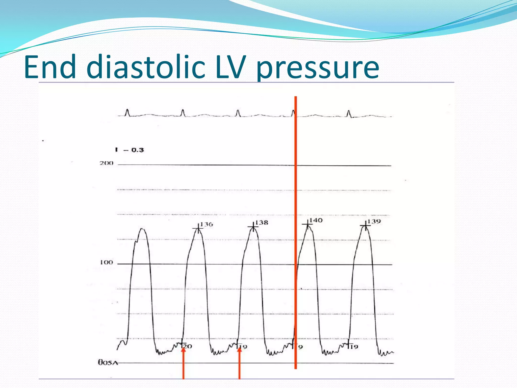End diastolic LV pressure

 