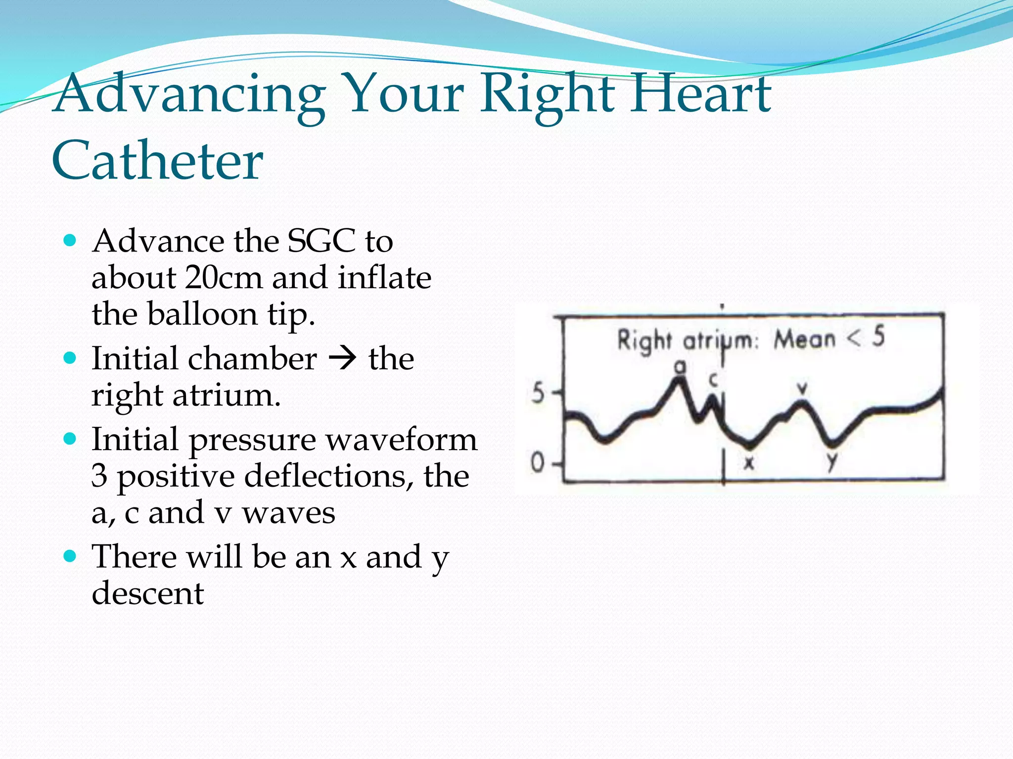 Advancing Your Right Heart
Catheter
 Advance the SGC to

about 20cm and inflate
the balloon tip.
 Initial chamber  the
right atrium.
 Initial pressure waveform
3 positive deflections, the
a, c and v waves
 There will be an x and y
descent

 
