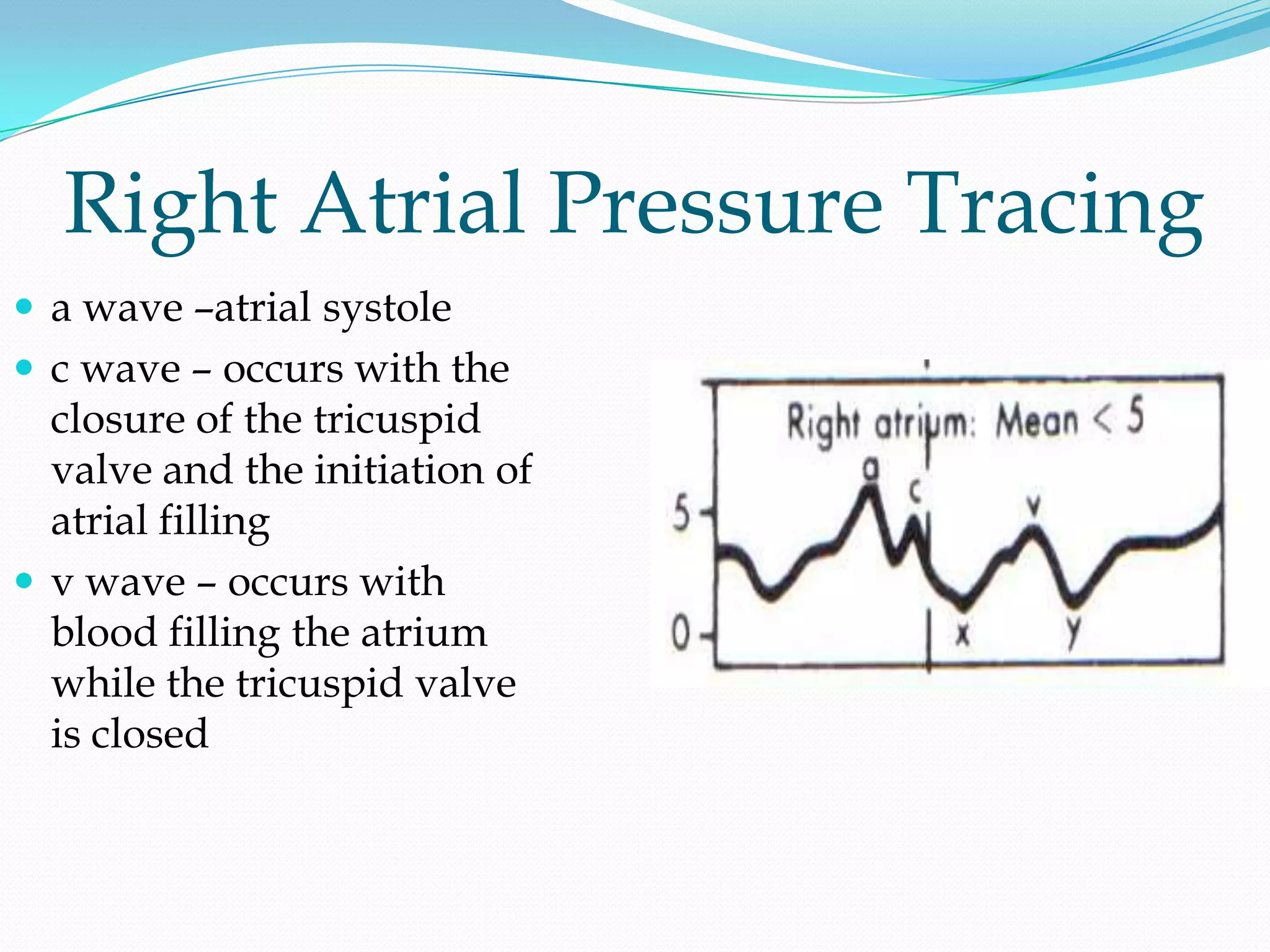Right Atrial Pressure Tracing
 a wave –atrial systole
 c wave – occurs with the

closure of the tricuspid
valve and the initiation of
atrial filling
 v wave – occurs with
blood filling the atrium
while the tricuspid valve
is closed

 