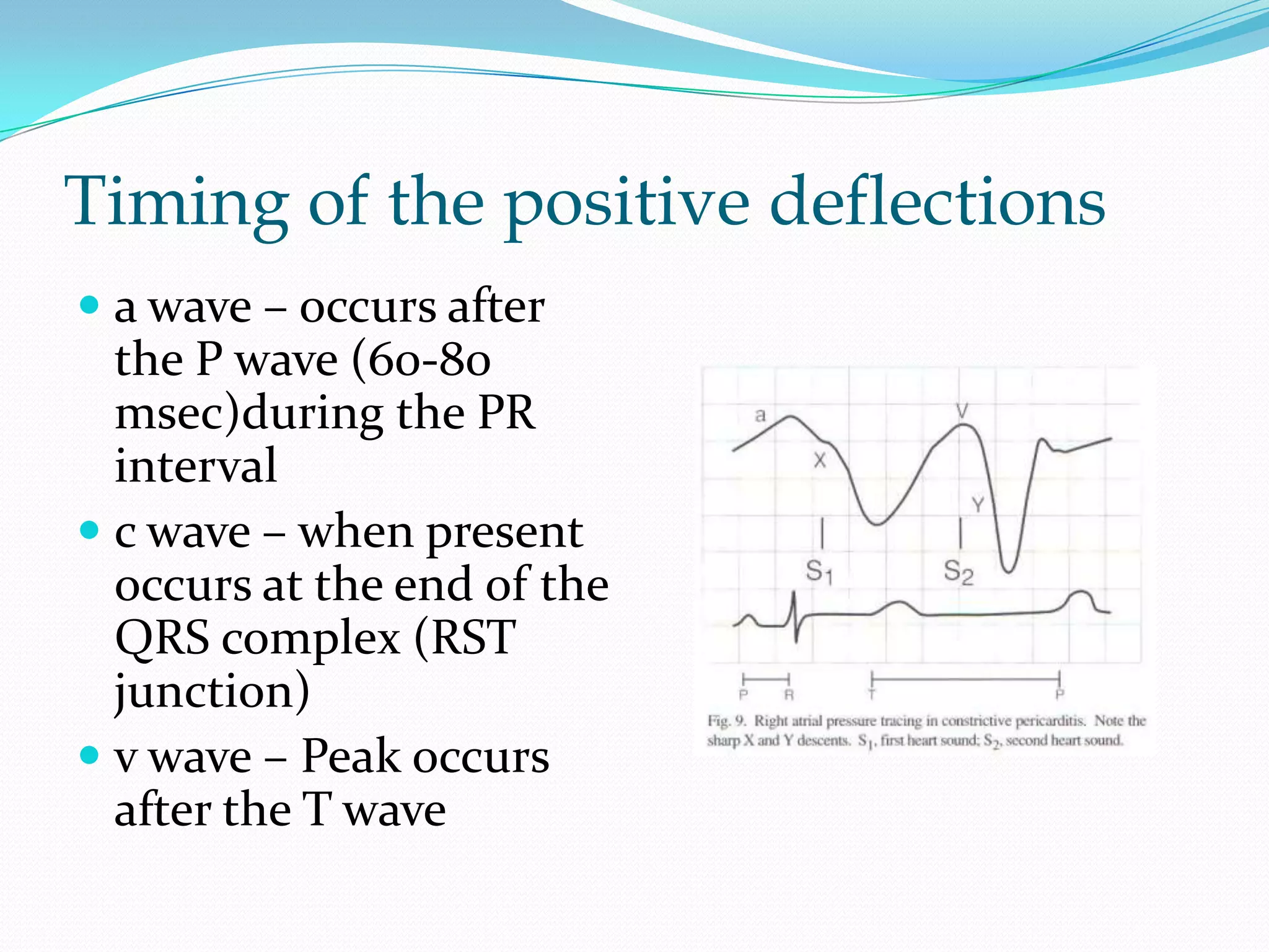 Timing of the positive deflections
 a wave – occurs after
the P wave (60-80
msec)during the PR
interval
 c wave – when present
occurs at the end of the
QRS complex (RST
junction)
 v wave – Peak occurs
after the T wave

 