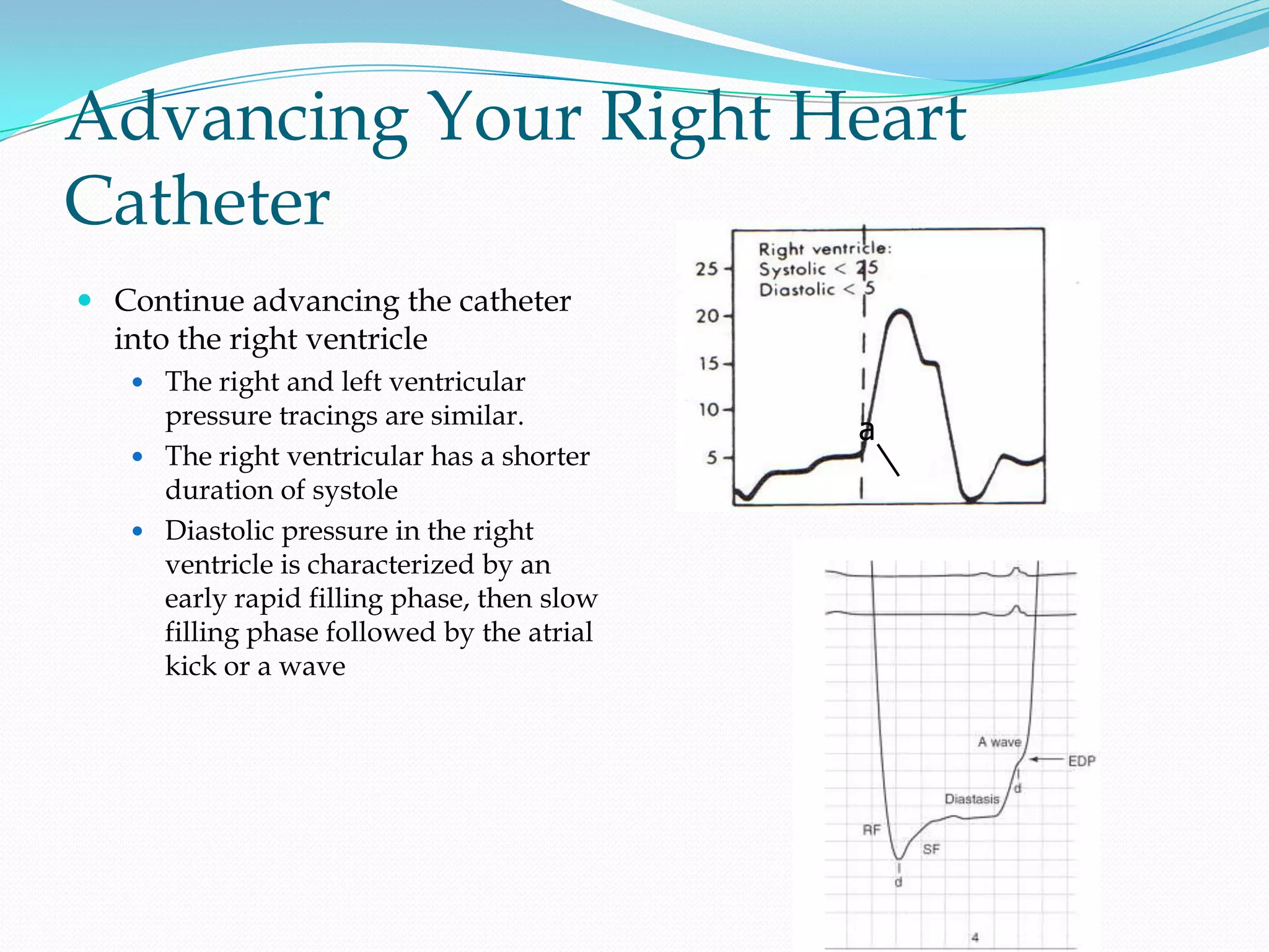 Advancing Your Right Heart
Catheter
 Continue advancing the catheter
into the right ventricle
 The right and left ventricular

pressure tracings are similar.
 The right ventricular has a shorter
duration of systole
 Diastolic pressure in the right
ventricle is characterized by an
early rapid filling phase, then slow
filling phase followed by the atrial
kick or a wave

a

 