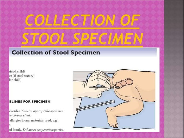 Collection of specimen in children. | PPT