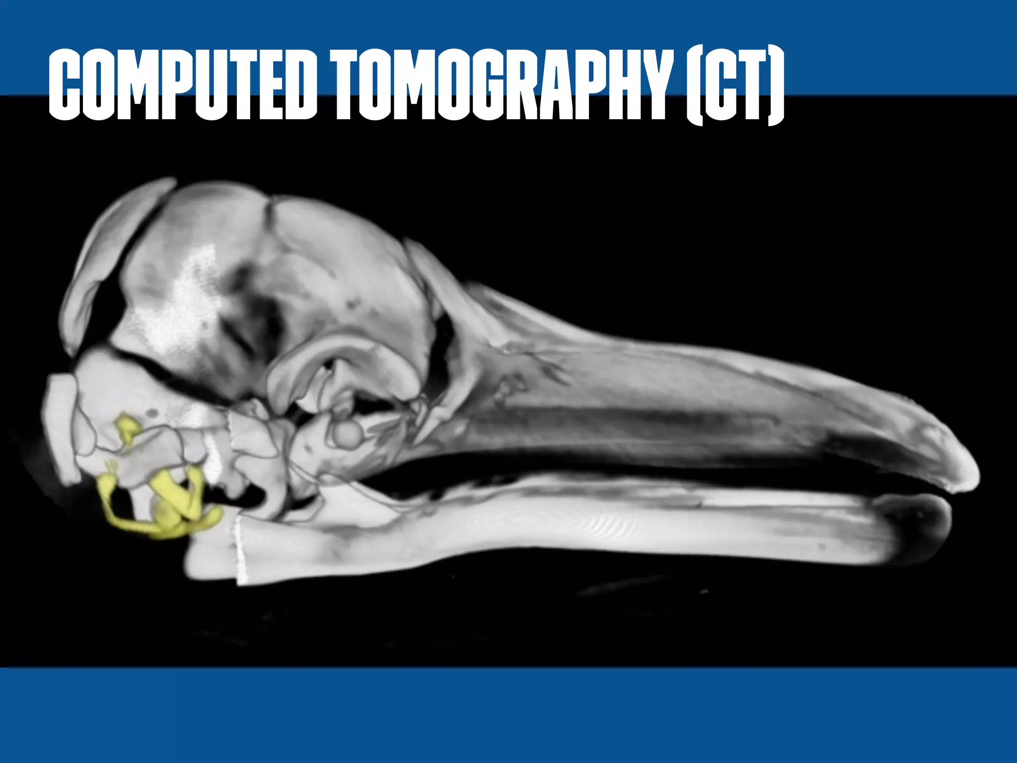 ComputedTomography(CT)
 