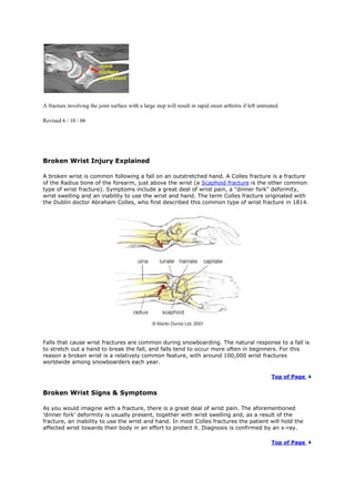 A fracture involving the joint surface with a large step will result in rapid onset arthritis if left untreated.
Revised 6 / 10 / 06
Broken Wrist Injury Explained
A broken wrist is common following a fall on an outstretched hand. A Colles fracture is a fracture
of the Radius bone of the forearm, just above the wrist (a Scaphoid fracture is the other common
type of wrist fracture). Symptoms include a great deal of wrist pain, a "dinner fork" deformity,
wrist swelling and an inability to use the wrist and hand. The term Colles fracture originated with
the Dublin doctor Abraham Colles, who first described this common type of wrist fracture in 1814.
Falls that cause wrist fractures are common during snowboarding. The natural response to a fall is
to stretch out a hand to break the fall, and falls tend to occur more often in beginners. For this
reason a broken wrist is a relatively common feature, with around 100,000 wrist fractures
worldwide among snowboarders each year.
Top of Page
Broken Wrist Signs & Symptoms
As you would imagine with a fracture, there is a great deal of wrist pain. The aforementioned
'dinner fork' deformity is usually present, together with wrist swelling and, as a result of the
fracture, an inability to use the wrist and hand. In most Colles fractures the patient will hold the
affected wrist towards their body in an effort to protect it. Diagnosis is confirmed by an x-ray.
Top of Page
 