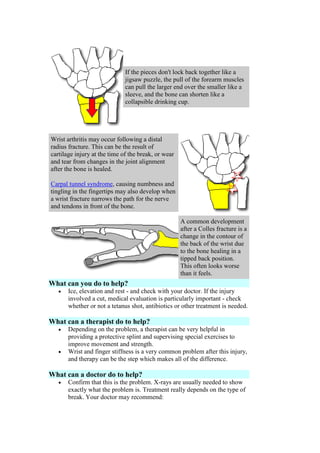 If the pieces don't lock back together like a
jigsaw puzzle, the pull of the forearm muscles
can pull the larger end over the smaller like a
sleeve, and the bone can shorten like a
collapsible drinking cup.
Wrist arthritis may occur following a distal
radius fracture. This can be the result of
cartilage injury at the time of the break, or wear
and tear from changes in the joint alignment
after the bone is healed.
Carpal tunnel syndrome, causing numbness and
tingling in the fingertips may also develop when
a wrist fracture narrows the path for the nerve
and tendons in front of the bone.
A common development
after a Colles fracture is a
change in the contour of
the back of the wrist due
to the bone healing in a
tipped back position.
This often looks worse
than it feels.
What can you do to help?
Ice, elevation and rest - and check with your doctor. If the injury
involved a cut, medical evaluation is particularly important - check
whether or not a tetanus shot, antibiotics or other treatment is needed.
What can a therapist do to help?
Depending on the problem, a therapist can be very helpful in
providing a protective splint and supervising special exercises to
improve movement and strength.
Wrist and finger stiffness is a very common problem after this injury,
and therapy can be the step which makes all of the difference.
What can a doctor do to help?
Confirm that this is the problem. X-rays are usually needed to show
exactly what the problem is. Treatment really depends on the type of
break. Your doctor may recommend:
 