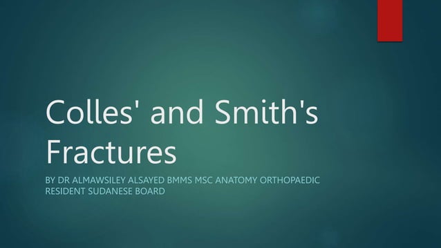 Colles' and Smith's fractures are common distal radius fractures with ...