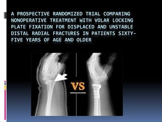 A PROSPECTIVE RANDOMIZED TRIAL COMPARING
NONOPERATIVE TREATMENT WITH VOLAR LOCKING
PLATE FIXATION FOR DISPLACED AND UNSTABLE
DISTAL RADIAL FRACTURES IN PATIENTS SIXTYFIVE YEARS OF AGE AND OLDER

 