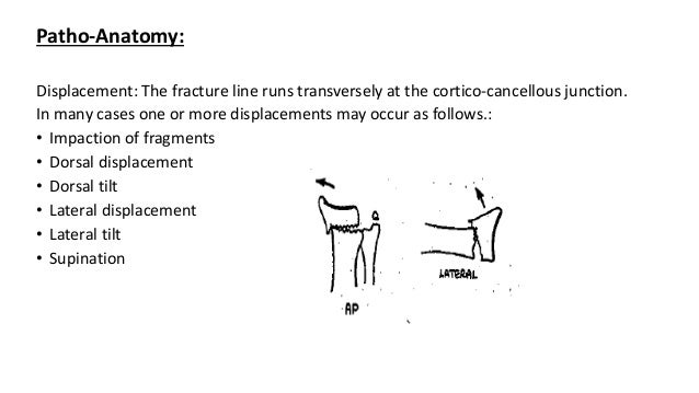 Colles fracture