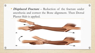 Colles fracture presentation | PPTX