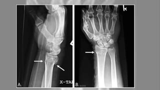 04-10-2020 ANNIE BLESSIE 23
 