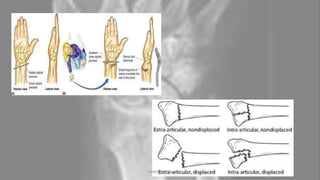 04-10-2020 ANNIE BLESSIE 7
 