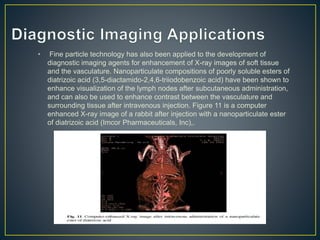 • Fine particle technology has also been applied to the development of
diagnostic imaging agents for enhancement of X-ray images of soft tissue
and the vasculature. Nanoparticulate compositions of poorly soluble esters of
diatrizoic acid (3,5-diactamido-2,4,6-triiodobenzoic acid) have been shown to
enhance visualization of the lymph nodes after subcutaneous administration,
and can also be used to enhance contrast between the vasculature and
surrounding tissue after intravenous injection. Figure 11 is a computer
enhanced X-ray image of a rabbit after injection with a nanoparticulate ester
of diatrizoic acid (Imcor Pharmaceuticals, Inc),.
 