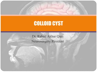 Dr. Rabail Akbar Qazi
Neurosurgery Resident
COLLOID CYST
 