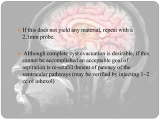 Colloid cyst | PPTX