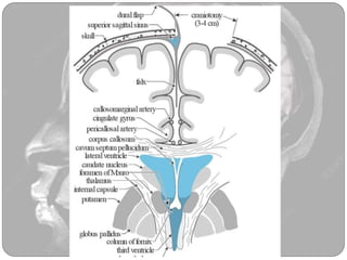 Colloid cyst | PPTX