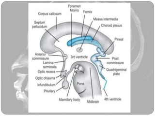 Colloid cyst | PPTX