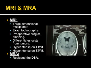  MRI:
 Three dimensional,
multiplanar.
 Exact tophography.
 Preoperative surgical
planning.
 Differentiates cysts
from tumors.
 Hyperintense on T1WI
 Hyperintense on T2WI.
 MRA:
 Replaced the DSA.
 