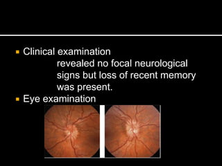  Clinical examination
revealed no focal neurological
signs but loss of recent memory
was present.
 Eye examination
 