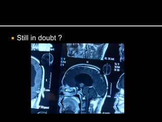  Still in doubt ?
 