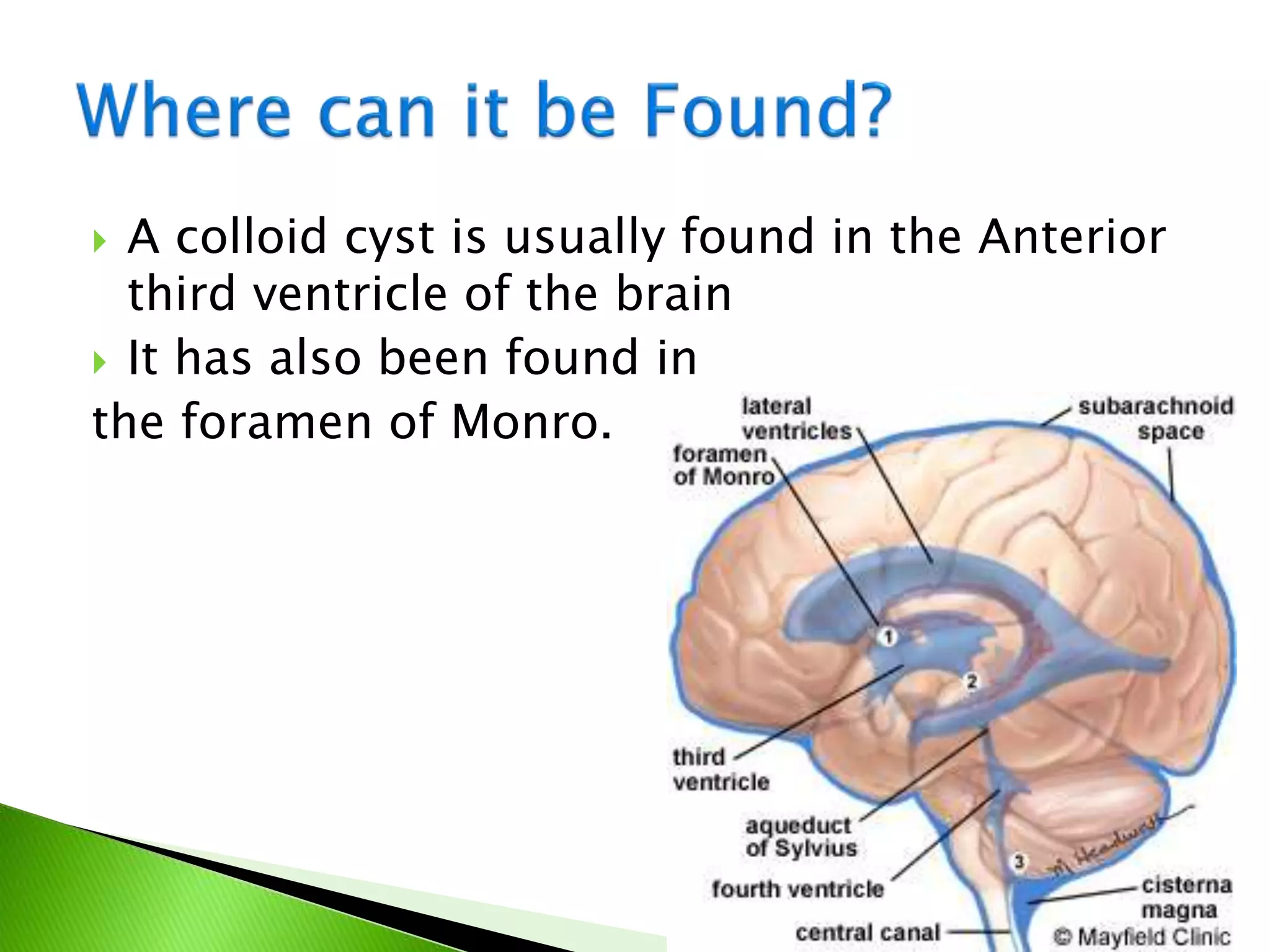  A colloid cyst is usually found in the Anterior
third ventricle of the brain
 It has also been found in
the foramen of Monro.
 