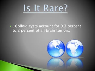  . Colloid cysts account for 0.3 percent
to 2 percent of all brain tumors.
 