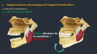Diduction dysfonctionnement de l'appareil manducateur et orthodontie Dr A.Hamid ...
