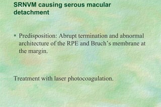  Predisposition: Abrupt termination and abnormal
architecture of the RPE and Bruch’s membrane at
the margin.
Treatment with laser photocoagulation.
SRNVM causing serous macular
detachment
 